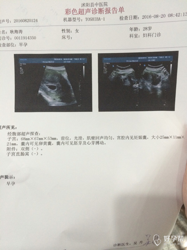 懷孕多少天可以查出來，全面解析早期妊娠檢測方式，懷孕多少天可以檢測出來？早期妊娠檢測方式的全面解析